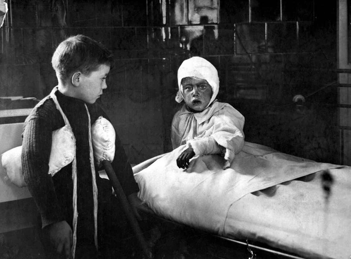 London, 1915: Während des Ersten Weltkriegs wurden diese Kinder bei einem Luftangriff der Deutschen verletzt.
