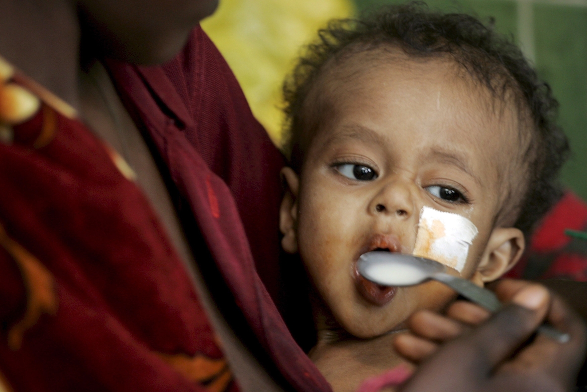 Ein unterernährtes Kleinkind wird von seiner Mutter in einer Klinik von "Ärzte ohne Grenzen" gefüttert.